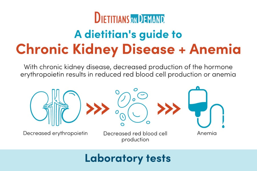 Chronic Kidney Disease & Anemia | Infographic – Dietitians On Demand